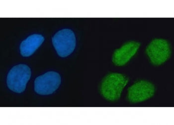 hnRNP K Antibody / HNRNPK / TUNP