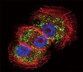 Parkin Antibody