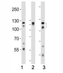 Fibroblast growth factor receptor 2 Antibody (FGFR2)