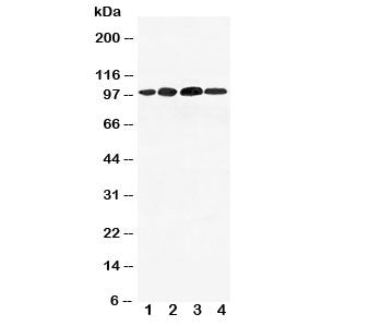 Mineralocorticoid Receptor Antibody