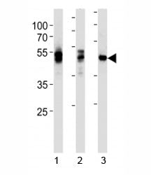 LCK Antibody