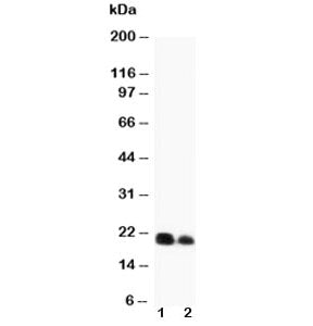 IL-6 Antibody