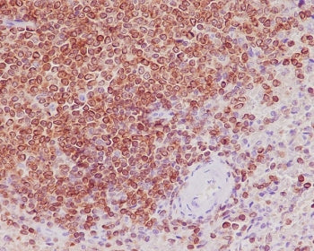 Bcl-2 Antibody
