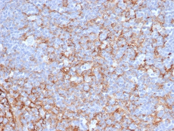 CD21 Antibody