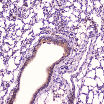 IHC testing of FFPE mouse lung tissue with Leptin antibody at 2ug/ml. HIER: boil tissue sections in
