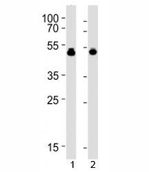 VASP antibody western blot analysis with 1) HUVEC and 2) THP-1 lysate. Expected molecular weight: ~4
