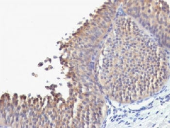 KRT10 Antibody / Cytokeratin 10