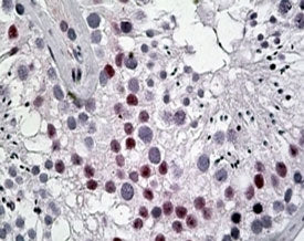 DENTT Antibody