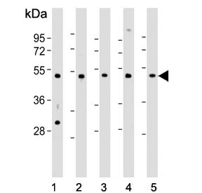 Western blot testing of 1) human A431, 2) rat C6, 3) human Jurkat, 4) human K562 and 5) human LNCaP