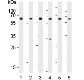 Erythropoietin Receptor Antibody / EPOR
