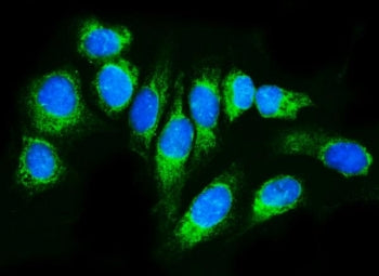 TRAP alpha Antibody / TRAPA / SSR1