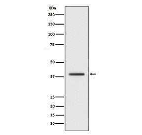 H2AFY Antibody / Macro H2A.1