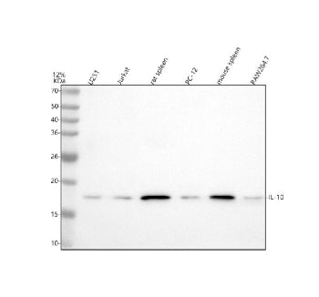 Western blot analysis of IL10 using anti-IL10 antibody. Lane 1: human U251 whole cell lysates, Lane