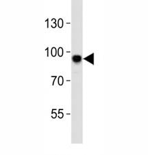 Western blot analysis of lysate from mouse NIH3T3 cell line using Sirt1 antibody at 1:1000. Visualiz