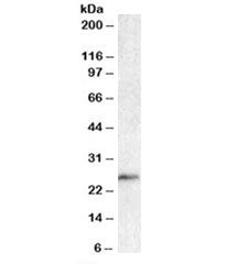 BCL7A Antibody