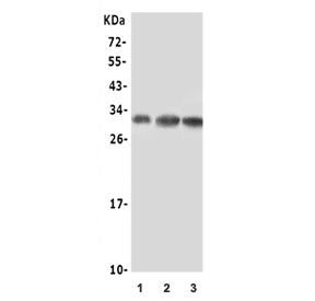 NGF Antibody / Beta NGF