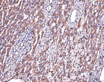 Alpha-2-Antiplasmin Antibody / SERPINF2