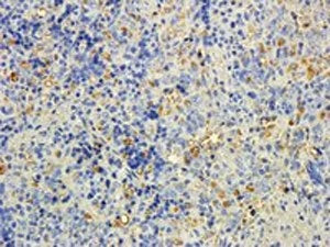 IHC staining of FFPE rat spleen with MTMR9 antibody at 5ug/ml. HIER: steamed with pH6 citrate buffer