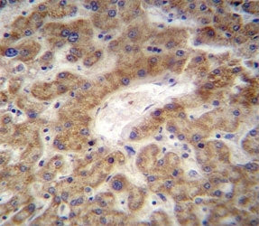 CXCL12 antibody immunohistochemistry analysis in formalin fixed and paraffin embedded human liver ti