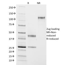 SDS-PAGE analysis of purified, BSA-free ASRGL1 antibody (clone CRASH/1290) as confirmation of integr