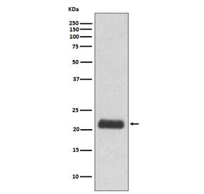 GPX1 Antibody / Glutathione Peroxidase 1