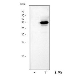 IL1 beta Antibody