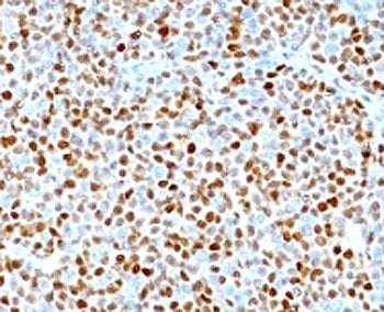 Cyclin D1 Antibody / CCND1