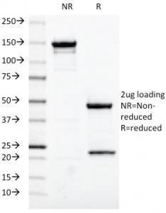 SDS-PAGE analysis of purified, BSA-free Estrogen Receptor alpha antibody (ESR1/420) as confirmation