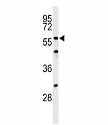CDC25C Antibody