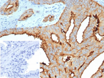 TMPRSS2 Antibody
