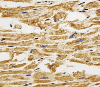 FABP3 Antibody