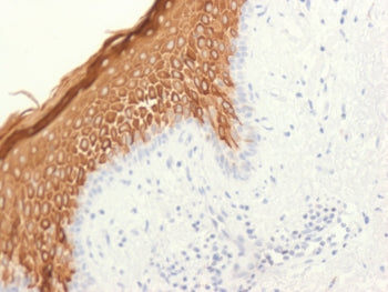 KRT10 Antibody / Cytokeratin 10