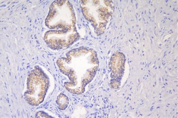 Desmoglein 2 Antibody / DSG2