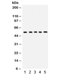 Western blot testing of 1) rat liver, 2) rat lung, 3) human HepG2, 4) HeLa and 5) mouse HEPA1-6 lysa