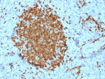 IHC testing of FFPE human spleen with BOB1 antibody (clone BOB1/2421). HIER: boil tissue sections in