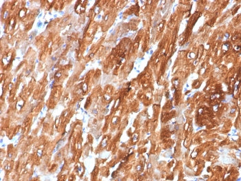Alpha B Crystallin Antibody / CRYAB