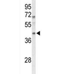 Western blot analysis of MAFA antibody and mouse spleen tissue lysate. Predicted molecular weight ~3