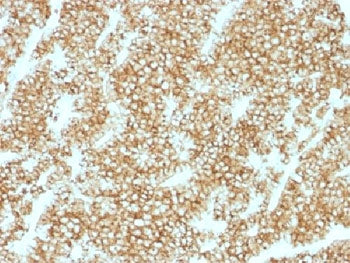 Parathyroid Hormone Antibody / N Terminal
