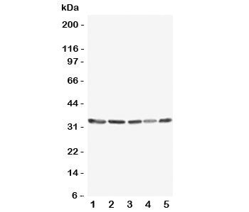 Western blot testing of TNFAIP8L3 antibody and Lane 1: MCF-7; 2: SW620; 3: COS7; 4: SKOV; 5: Jurkat