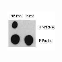 Phospho-ATF2 Antibody (pS322)