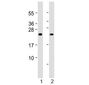 MYL1 Antibody (N-Terminal Region)
