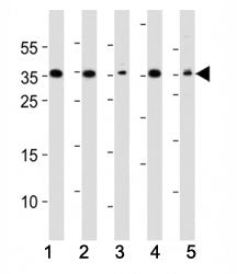 Western blot analysis of lysate from (1) A549, (2) HeLa, (3) HepG2, (4) Jurkat, (5) mouse NIH3T3 cel