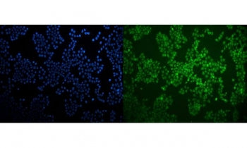 Immunofluorescent staining of FFPE human MCF7 cells with LXR beta antibody (green) and DAPI nuclear