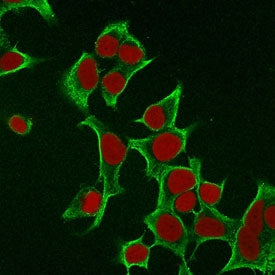 Immunofluorescent staining of permeabilized human MCF7 cells with Cytokeratin 8 antibody (clone B22.