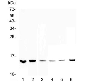 WFDC2 Antibody / HE4
