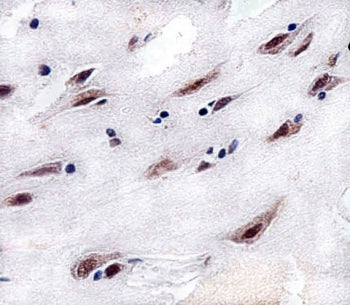 CSNK2A1 Antibody