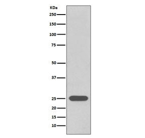 PGP9.5 / UchL1 Antibody