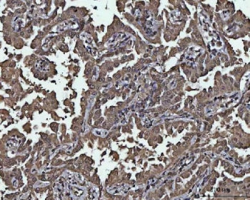 PPP4C Antibody / PP-X