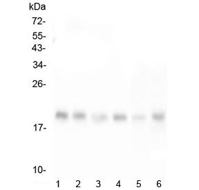 RMI2 Antibody / RecQ-mediated genome instability protein 2