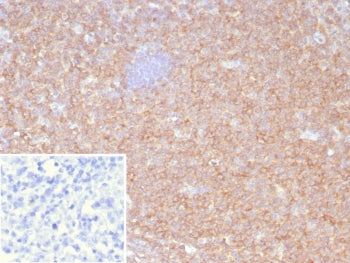 HLA-B Antibody (MHC Class I)